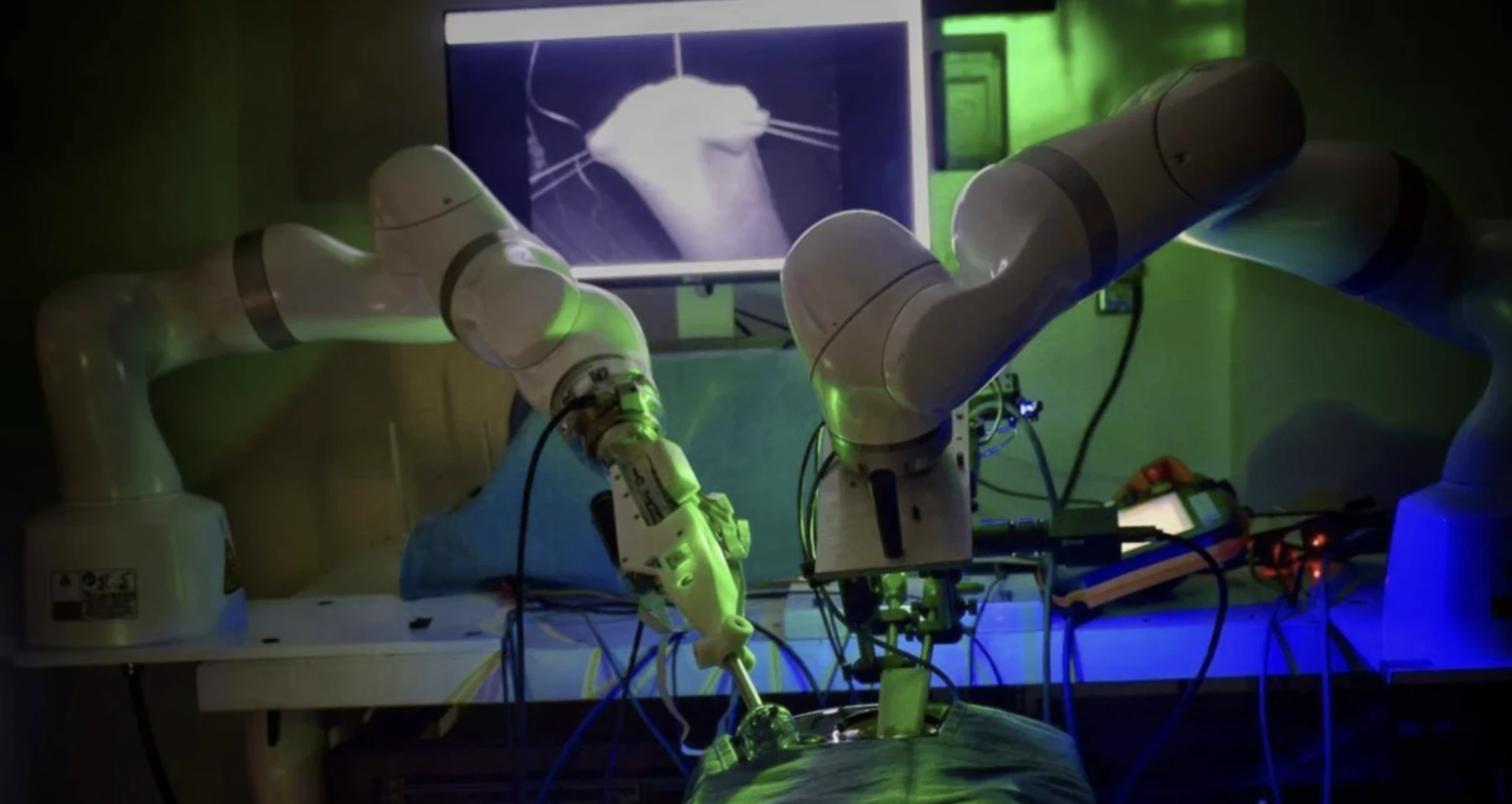 An example of healthcare AI use cases: robotic surgery