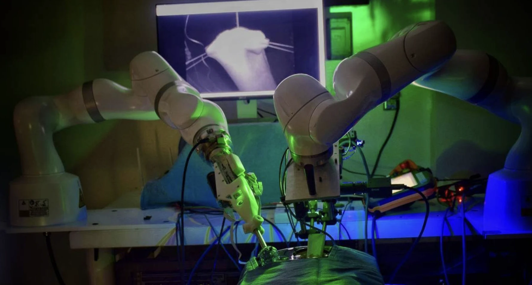 Un esempio di applicazione dell'IA in ambito sanitario: la chirurgia robotica. Un esempio di applicazione dell'IA in ambito sanitario: la chirurgia robotica.