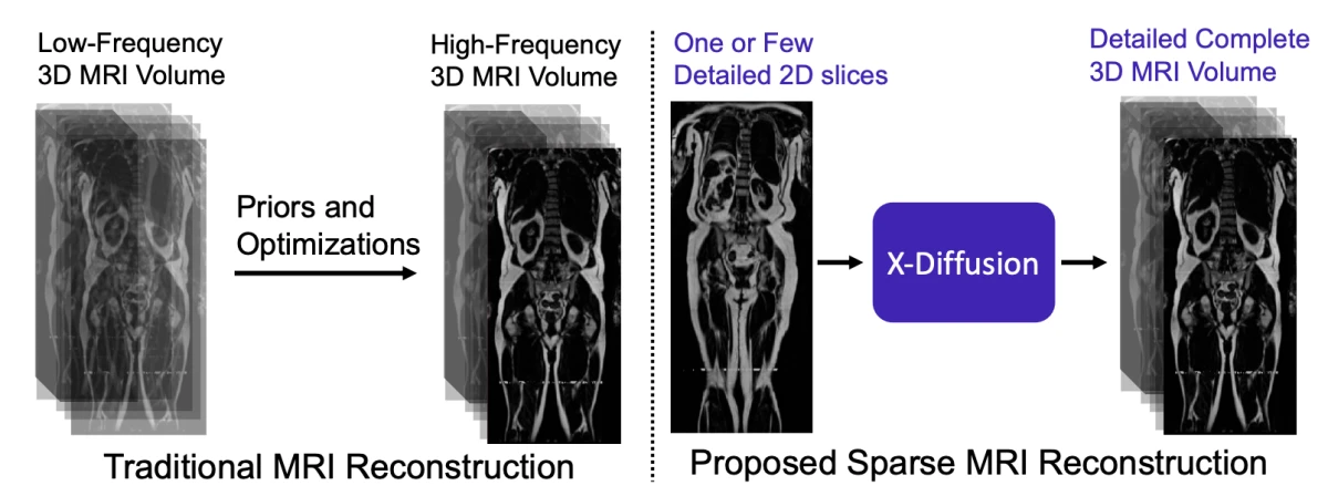 An example for generative AI healthcare applications: A comparison between traditional MRI reconstruction vs X-Diffusion. An example for generative AI healthcare applications: A comparison between traditional MRI reconstruction vs X-Diffusion.